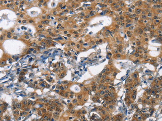 DCC Polyclonal Antibody Store at -20°C - Biomarkers - Elabscience Biotechnology - MSE Supplies