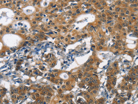 DCC Polyclonal Antibody Store at -20°C - Biomarkers - Elabscience Biotechnology - MSE Supplies