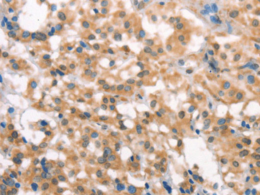 LATS2 Polyclonal Antibody Store at -20°C - Biomarkers - Elabscience Biotechnology - MSE Supplies