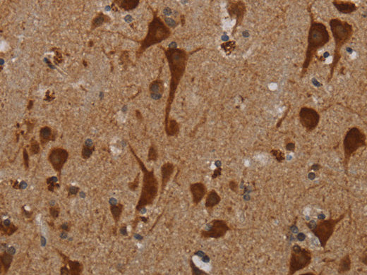 KMT2D Polyclonal Antibody Store at -20°C - Biomarkers - Elabscience Biotechnology - MSE Supplies