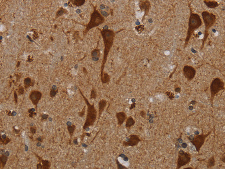 KMT2D Polyclonal Antibody Store at -20°C - Biomarkers - Elabscience Biotechnology - MSE Supplies