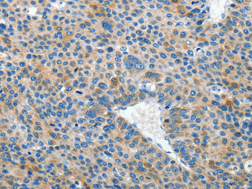 EPHB3 Polyclonal Antibody Store at -20°C - Biomarkers - Elabscience Biotechnology - MSE Supplies