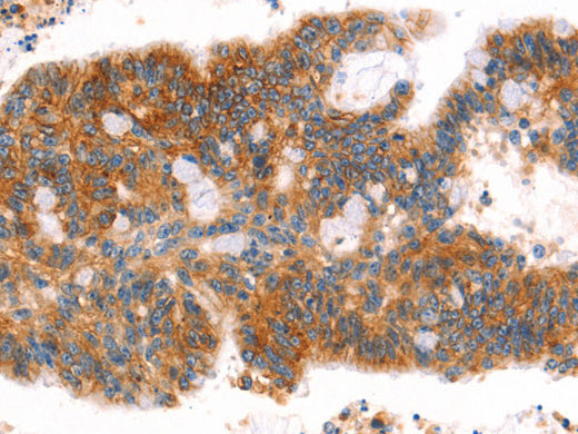 AFDN Polyclonal Antibody Store at -20°C - Biomarkers - Elabscience Biotechnology - MSE Supplies