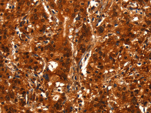 BCAS3 Polyclonal Antibody Store at -20°C - Biomarkers - Elabscience Biotechnology - MSE Supplies