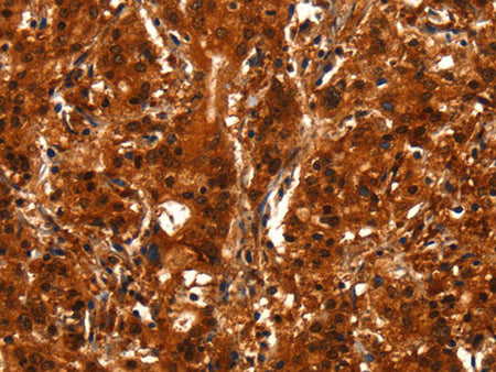 BCAS3 Polyclonal Antibody Store at -20°C - Biomarkers - Elabscience Biotechnology - MSE Supplies