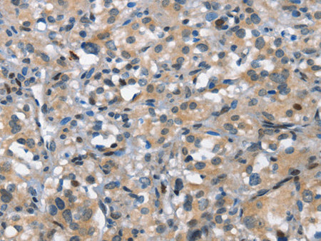 DDR2 Polyclonal Antibody Store at -20°C - Biomarkers - Elabscience Biotechnology - MSE Supplies