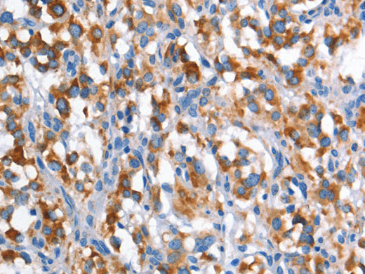 CD226 Polyclonal Antibody Store at -20°C - Biomarkers - Elabscience Biotechnology - MSE Supplies