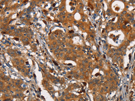 CEACAM3 Polyclonal Antibody Store at -20°C - Biomarkers - Elabscience Biotechnology - MSE Supplies