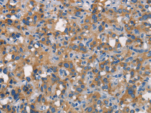 CEACAM6 Polyclonal Antibody Store at -20°C - Biomarkers - Elabscience Biotechnology - MSE Supplies