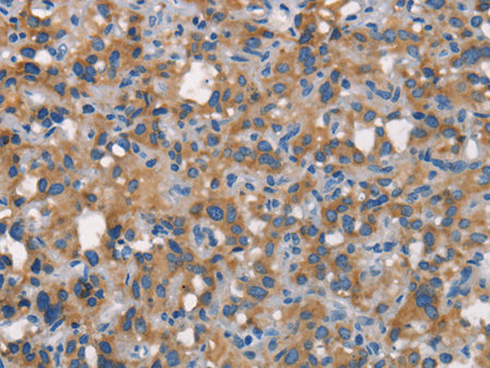 CEACAM6 Polyclonal Antibody Store at -20°C - Biomarkers - Elabscience Biotechnology - MSE Supplies