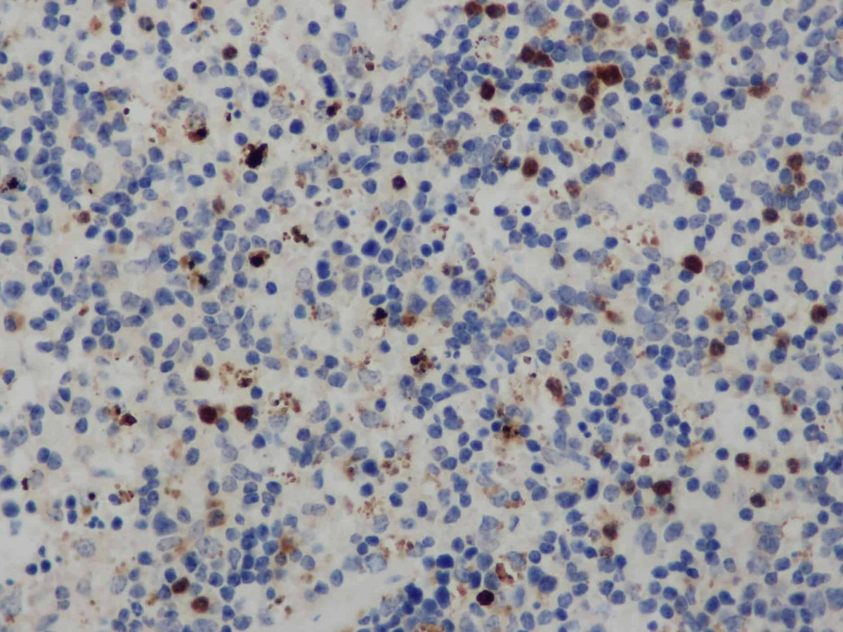 CD68 Polyclonal Antibody Store at -20°C - Biomarkers - Elabscience Biotechnology - MSE Supplies