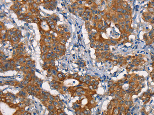 CDC23 Polyclonal Antibody Store at -20°C - Biomarkers - Elabscience Biotechnology - MSE Supplies