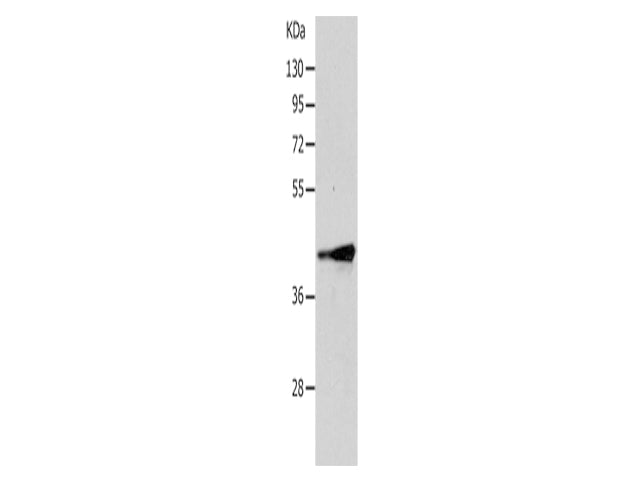 TRIM63 Polyclonal Antibody Store at -20°C - Biomarkers - Elabscience Biotechnology - MSE Supplies