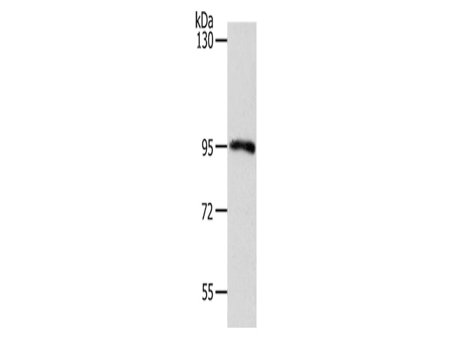 MYSM1 Polyclonal Antibody Store at -20°C - Biomarkers - Elabscience Biotechnology - MSE Supplies