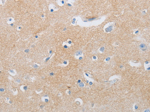 CD10 Polyclonal Antibody Store at -20°C - Biomarkers - Elabscience Biotechnology - MSE Supplies