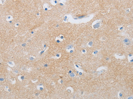 CD10 Polyclonal Antibody Store at -20°C - Biomarkers - Elabscience Biotechnology - MSE Supplies