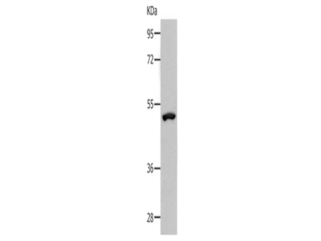 NDRG1 Polyclonal Antibody Store at -20°C - Biomarkers - Elabscience Biotechnology - MSE Supplies