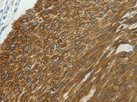 NDRG2 Polyclonal Antibody Store at -20°C - Biomarkers - Elabscience Biotechnology - MSE Supplies