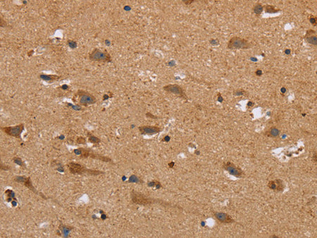 NDRG3 Polyclonal Antibody Store at -20°C - Biomarkers - Elabscience Biotechnology - MSE Supplies