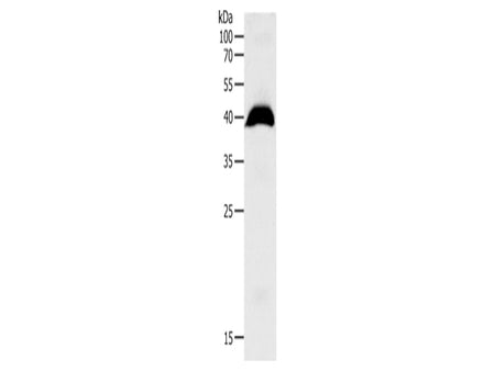 OPRL1 Polyclonal Antibody Store at -20°C - Biomarkers - Elabscience Biotechnology - MSE Supplies