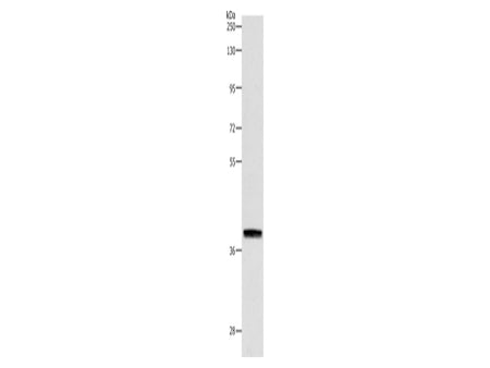 RTN4 Polyclonal Antibody Store at -20°C - Biomarkers - Elabscience Biotechnology - MSE Supplies