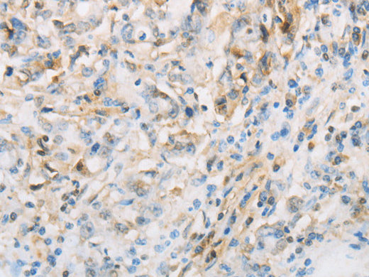 NPPC Polyclonal Antibody Store at -20°C - Biomarkers - Elabscience Biotechnology - MSE Supplies