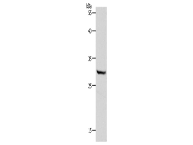 NQO1 Polyclonal Antibody Store at -20°C - Biomarkers - Elabscience Biotechnology - MSE Supplies