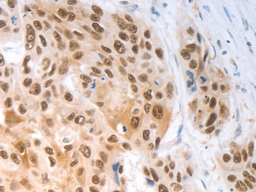SLC22A8 Polyclonal Antibody Store at -20°C - Biomarkers - Elabscience Biotechnology - MSE Supplies