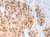 SLC22A8 Polyclonal Antibody Store at -20°C