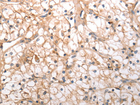 HCRTR1 Polyclonal Antibody Store at -20°C - Biomarkers - Elabscience Biotechnology - MSE Supplies