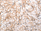 HCRTR1 Polyclonal Antibody Store at -20°C