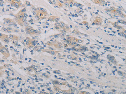 PTAFR Polyclonal Antibody Store at -20°C - Biomarkers - Elabscience Biotechnology - MSE Supplies