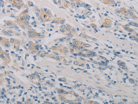 PTAFR Polyclonal Antibody Store at -20°C - Biomarkers - Elabscience Biotechnology - MSE Supplies