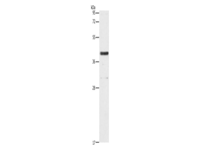 PAFAH2 Polyclonal Antibody Store at -20°C - Biomarkers - Elabscience Biotechnology - MSE Supplies