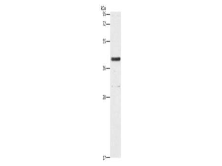 PAFAH2 Polyclonal Antibody Store at -20°C - Biomarkers - Elabscience Biotechnology - MSE Supplies