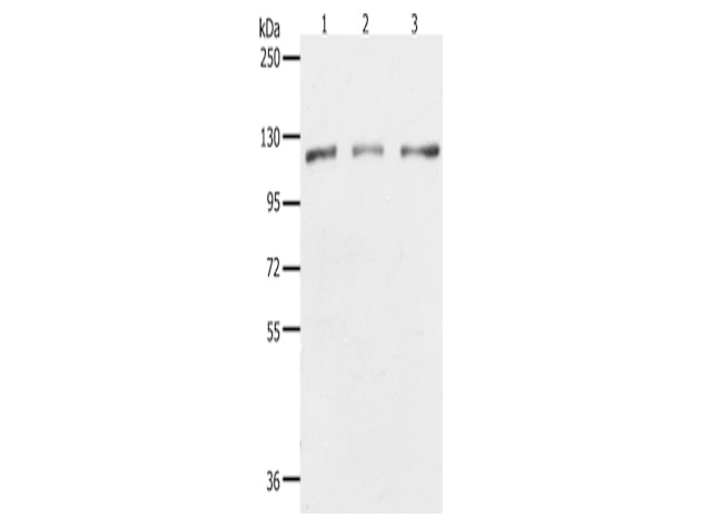 PARP1 Polyclonal Antibody Store at -20°C - Biomarkers - Elabscience Biotechnology - MSE Supplies