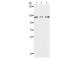 PARP1 Polyclonal Antibody Store at -20°C