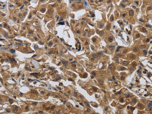 PDCD7 Polyclonal Antibody Store at -20°C - Biomarkers - Elabscience Biotechnology - MSE Supplies