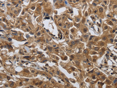 PDCD7 Polyclonal Antibody Store at -20°C - Biomarkers - Elabscience Biotechnology - MSE Supplies