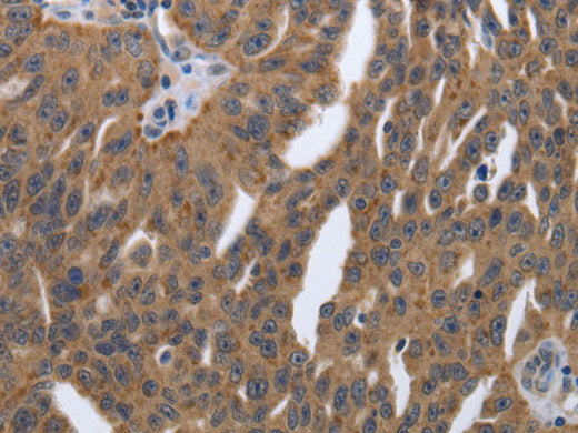 PDGFA Polyclonal Antibody Store at -20°C - Biomarkers - Elabscience Biotechnology - MSE Supplies