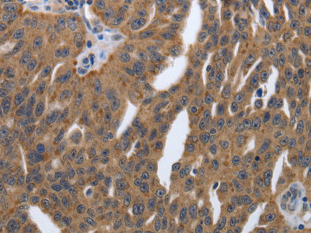 PDGFA Polyclonal Antibody Store at -20°C - Biomarkers - Elabscience Biotechnology - MSE Supplies