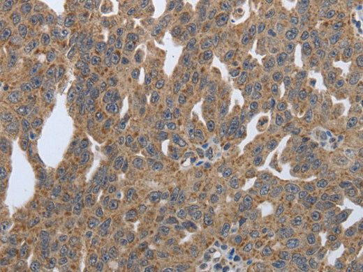 PDIA2 Polyclonal Antibody Store at -20°C - Biomarkers - Elabscience Biotechnology - MSE Supplies