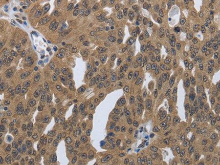 PRKAR1B Polyclonal Antibody Store at -20°C - Biomarkers - Elabscience Biotechnology - MSE Supplies