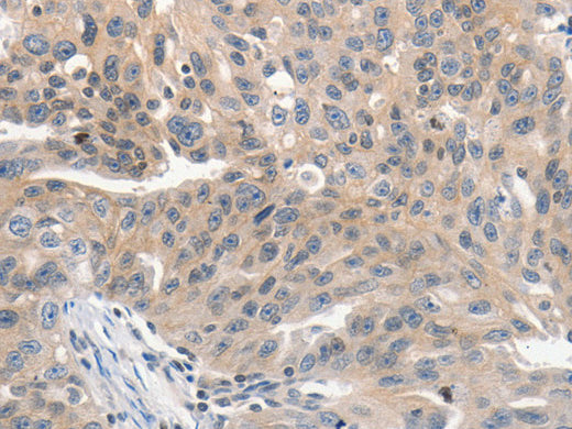 PRKD1 Polyclonal Antibody Store at -20°C - Biomarkers - Elabscience Biotechnology - MSE Supplies