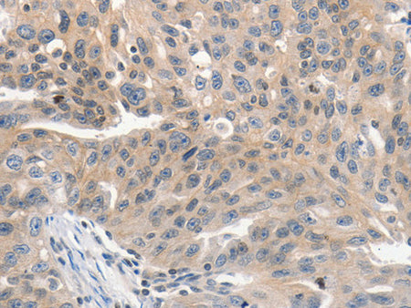 PRKD1 Polyclonal Antibody Store at -20°C - Biomarkers - Elabscience Biotechnology - MSE Supplies