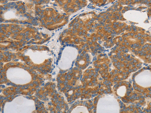 PPP2CB Polyclonal Antibody Store at -20°C - Biomarkers - Elabscience Biotechnology - MSE Supplies