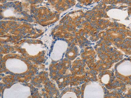 PPP2CB Polyclonal Antibody Store at -20°C - Biomarkers - Elabscience Biotechnology - MSE Supplies