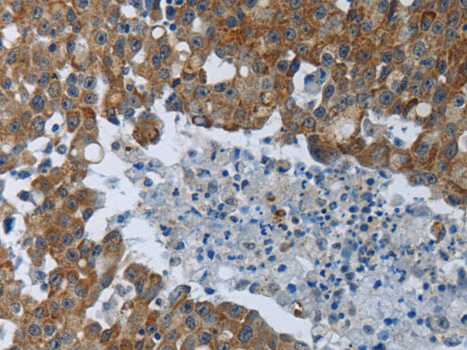 EIF2AK2 Polyclonal Antibody Store at -20°C - Biomarkers - Elabscience Biotechnology - MSE Supplies