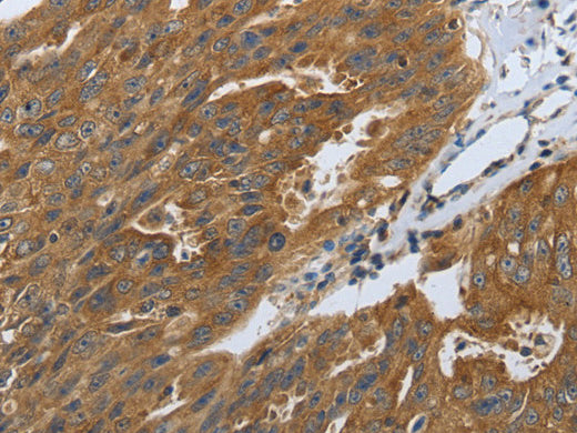 DLG4 Polyclonal Antibody Store at -20°C - Biomarkers - Elabscience Biotechnology - MSE Supplies