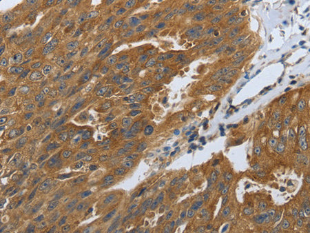 DLG4 Polyclonal Antibody Store at -20°C - Biomarkers - Elabscience Biotechnology - MSE Supplies